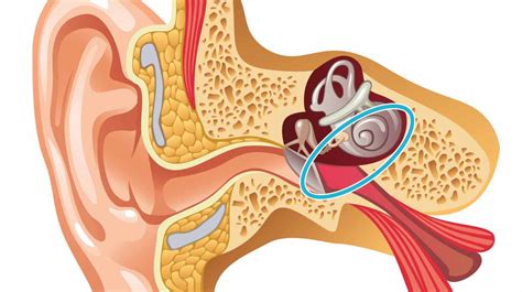 Types Of Hearing Loss Soundbright