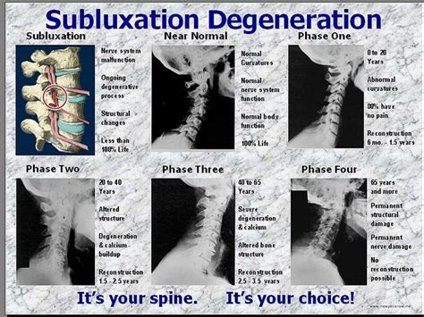 The raynor ergohuman is one of the best chairs for lower back pain firstly because it has a back angle adjustment so you can choose the best recline position. 40 best Spinal Degeneration images on Pinterest | Clean ...