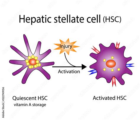 Hepatic Stellate Cell Activation Quiescent And Activated Hscs Hepatic