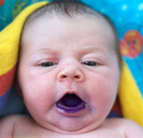 Gentian Violet Deep Purple Dye Kills Some Cancer Cells