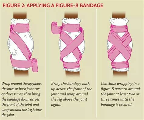 Figure Of Eight Bandage