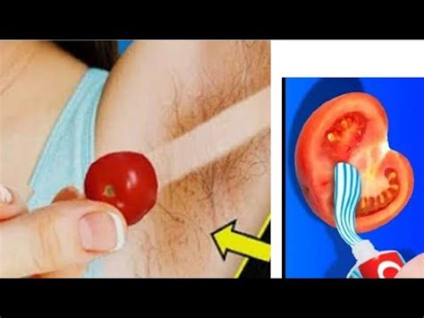 Cleanse your skin using a mild cleanser in order to remove any bacteria and debris that can cause an infection. IN 5 MINUTES REMOVE UNWANTED ARMPIT HAIR |BEST WAY TO ...