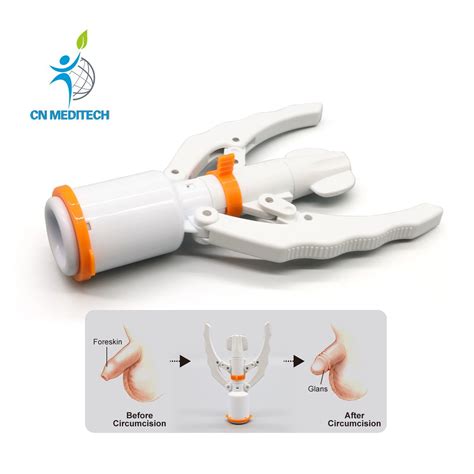 Disposable Circumcision Clamp Device Surgical Circumcision Stapler For