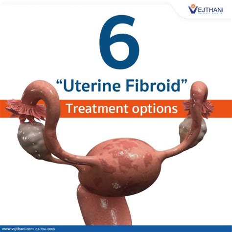Uterine Fibroid Treatment Options Vejthani Hospital