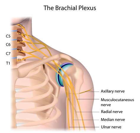 Top Homeopathic Medicines For Brachial Neuritis Homeopathy At DrHomeo Com