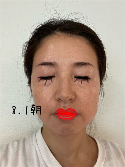 ゼオスキンで30代のシミ肌が若返る!!（2か月目経過報告 ...