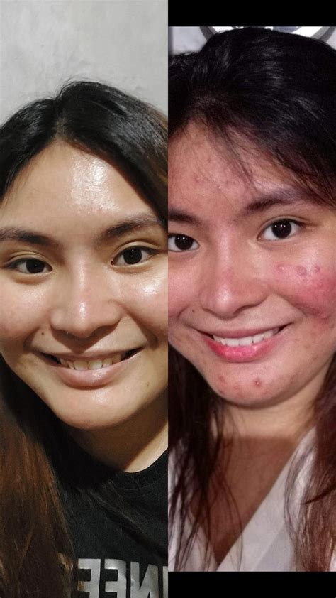 Best Way To Whiten Your Tuhod And Siko Rbeautytalkph
