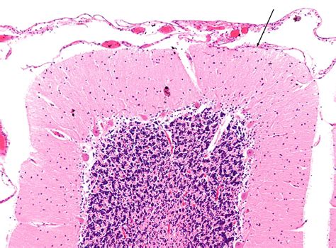 Neurohistology → Cerebellum — Histological Samples Meddists