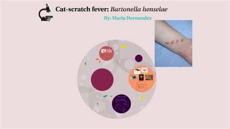 Cat Scratch Fever Bartonella Henselae By Maria Hernandez