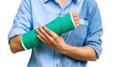 Does A Broken Arm Justify Making A Compensation Claim