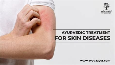 Skin Diseases Ayurvedic Treatment For Skin Diseases