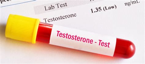 The Differences Between Testosterone Therapy And Taking Steroids