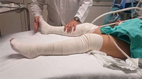 Hiperreflexia O Que é