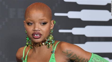 Model Slick Woods Tells Fans Not To Treat Her Like A Victim After
