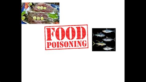 Food Poisoning Ciguatera Scombroid Botulism Youtube