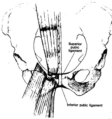 Surgery For Osteitis Pubis Abstract Europe Pmc