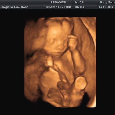 30 Weeks Pregnant 4d Ultrasound Nibhtwc