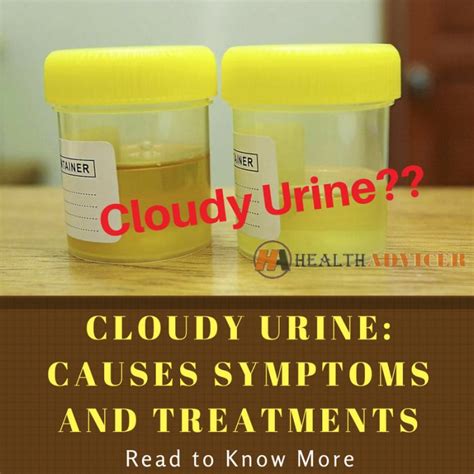 Cloudy Urine Causes Picture Symptoms And Treatment