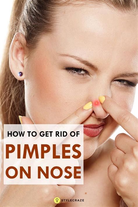 6 Easy Diy Remedies To Get Rid Of Pimples On The Nose How To Get Rid