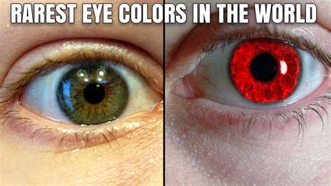 Top 5 Rarest Eye Colors