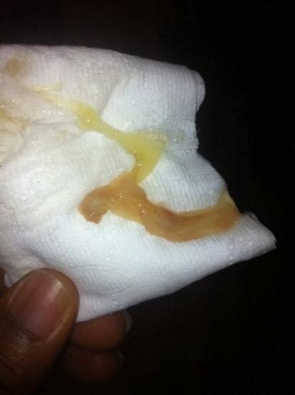 We did not find results for: See what a mucous plug looks like (Photos) | BabyCenter