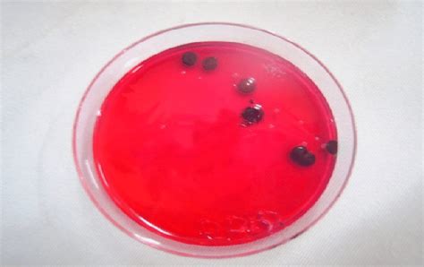 Colonies Of Salmonella Typhimurium Growth On Xld Agar Colonies Appear