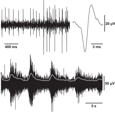 Samples Of Genioglossus Electromyogram Emg Recorded With The
