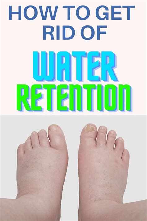 How To Get Rid Of Water Retention Fast In The Body Naturally Epic
