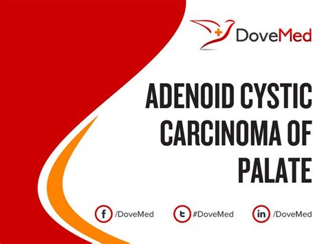 Cancer research uk is a registered charity in england and wales (1089464), scotland (sc041666), the isle of man (1103) and jersey (247). Adenoid Cystic Carcinoma of Palate