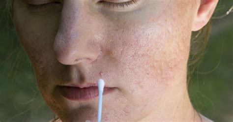 Skin Allergic Reactions Whats Causing That Rash Just How Typically