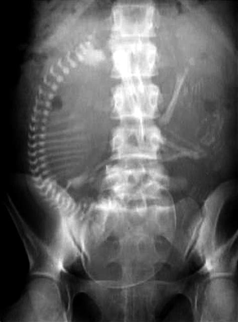 Pregnancy X Ray Anatomybox