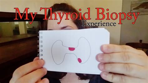 My Thyroid Biopsy Experience Youtube