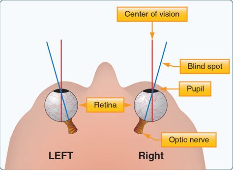 Human Factors The Blind Spot Learn To Fly Blog Asa