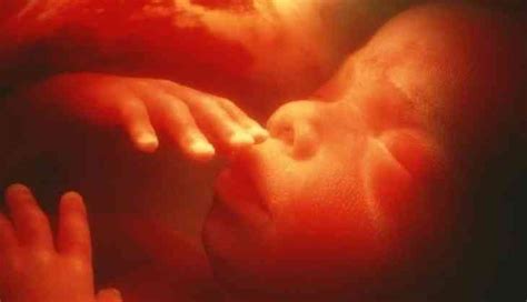 Medical Miracle Unborn Baby Removed From Mothers Womb For Surgery In Uk Then Put Back Reason
