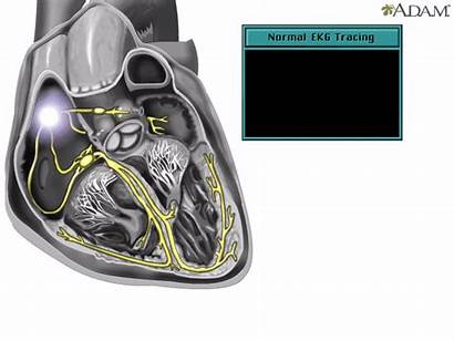Conduction System Intrinsic Cardiac Heart Bio160 Kaylee