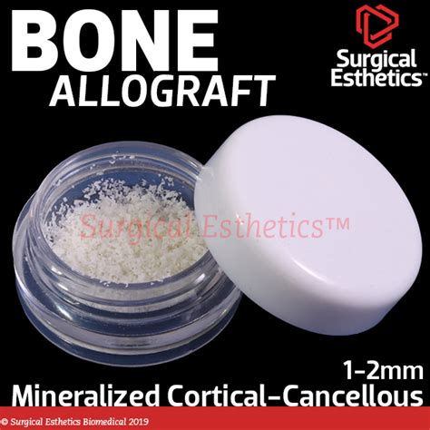 Ossif I Mineralized Cortical Cancellous Bone Allograft Large Particle