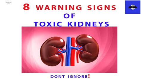 8 Warnings Signs That Your Kidneys Are Toxic Dont Ignore Them