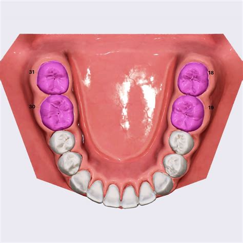 Mandibular Molars Molars Dental Anatomy Anatomyapp Learn