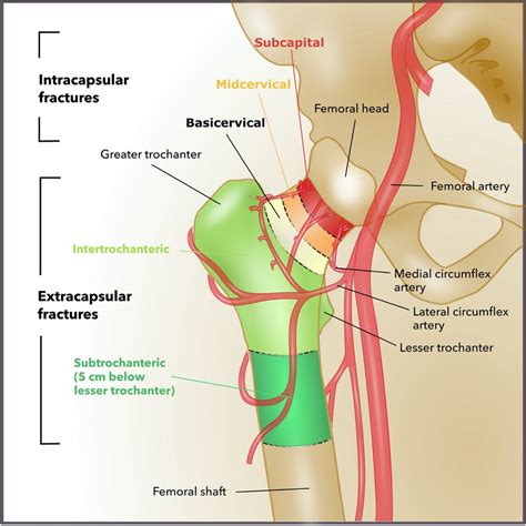 Femur Anatomy Proximal Distal And Shaft Kenhub Porn Sex Picture