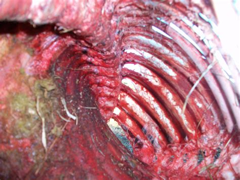 The ribcage consists of 12 paired bones which function to protect internal thoracic organs whilst one of the main functions of the thoracic spine is to help protect internal organs within the thorax. New mysterious mutilations in Colorado's San Luis Valley ...