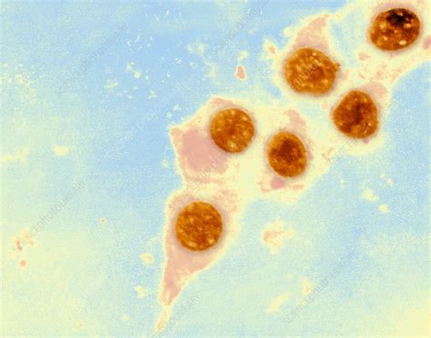 Chlamydia Trachomatis Bacteria Tem Stock Image C0022855 Science