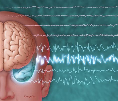 Early Seizures Following Traumatic Brain Injury Tied To Poor Outcomes