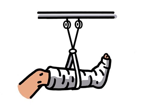 Broken Leg Cartoon Clipart Best