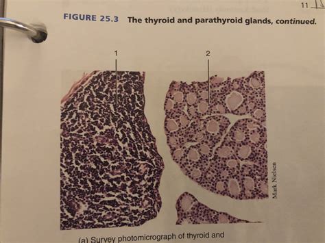 Photomicrograph Of Thyroid And Parathyroid Gland Diagram Quizlet