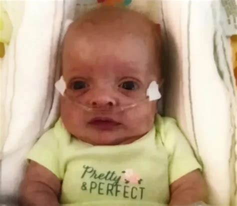 Baby Girl Born At 29 Weeks Who Had No Hospital Visitors Adopted By