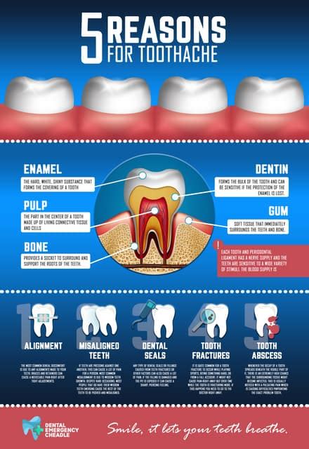 5 Reasons For Toothache Pdf