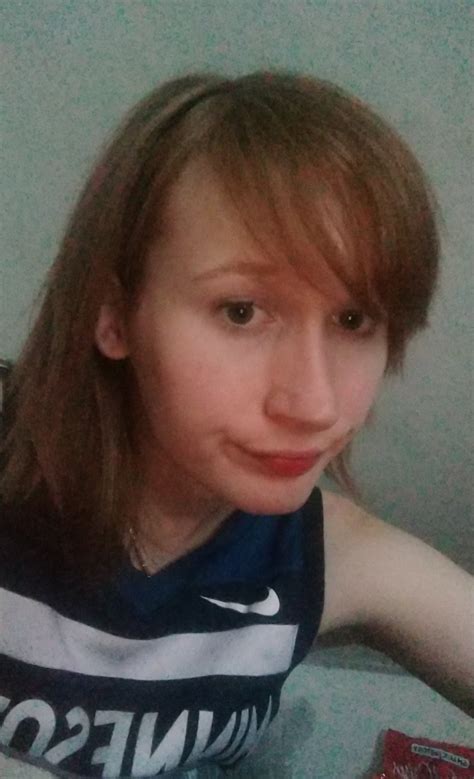 I feel so ugly, I have no upper lip, my nose, brow, and jawline will