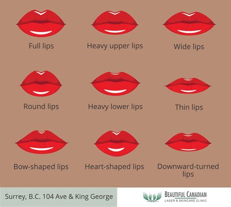 Malinconia Operazione Possibile Artistico Types Of Lip Fillers