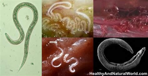 The keto diet plan do's and don'ts. How to Get Rid of Worms in Humans (Including Parasite