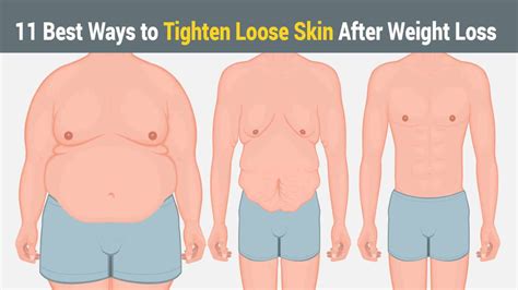 11 Best Ways To Tighten Loose Skin After Weight Loss 5 Minute Read
